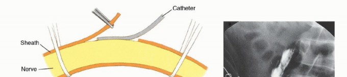 وصف طبي دقيق للمريض