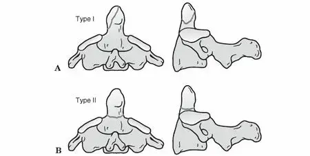 صورة توضيحية لـ كسور النتوء السني (النتوء السني للعظم المحوري): دليل شامل للمريض في اليمن والخليج مع الأستاذ الدكتور محمد هطيف