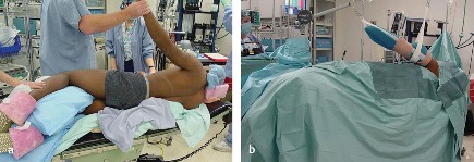 Complications in Arthroscopic Shoulder Surgery: What You Must Know