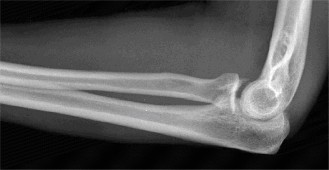 Illustration 97 for Acad Orthop Surg Challenge: Diagnose Shoulder Pain Case 1