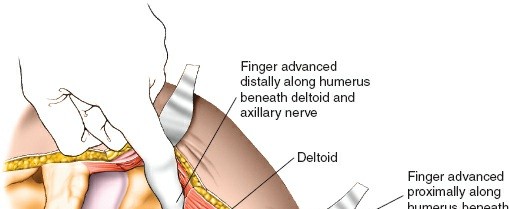 Illustration 118 for Essential Guide: Mastering Every Approach to the Shoulder
