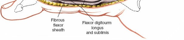 Illustration 166 for Essential Surgical Approaches: Uncover Every Aspect of the Wrist