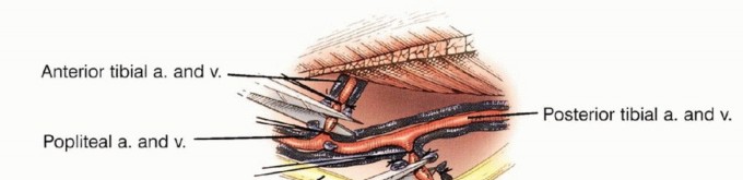 صورة طبية: معالجة الأورام المعقدة في قصبة الساق القريبة حلول الحفاظ على الأطراف