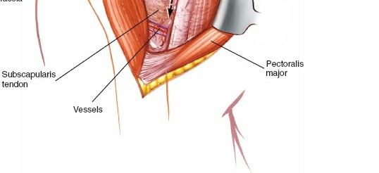 Illustration 21 for Essential Guide: Mastering Every Approach to the Shoulder