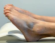 Illustration 18 for Partial Articular Fractureplate Fixation: Restore Anatomy