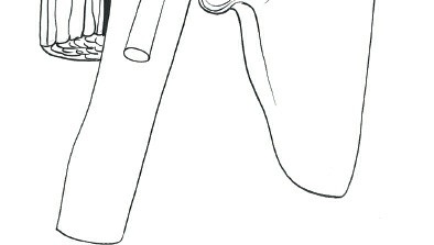 Illustration 146 for Essential Guide: Mastering Every Approach to the Shoulder