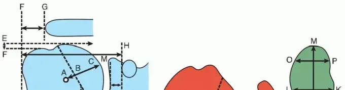 صورة توضيحية لـ الاستبدال الكلي لمفصل الكتف: دليل المريض الشامل لاستعادة الحياة بلا ألم مع الأستاذ الدكتور محمد هطيف