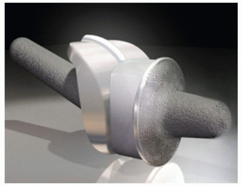 Roto-Glide: Achieve Optimal First Metatarsophalangeal Total Mobility