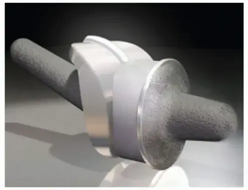 صورة توضيحية لـ وداعاً لألم إبهام القدم: دليل شامل لاستبدال مفصل المشط السلامي الأول بتقنية Roto-Glide المتقدمة