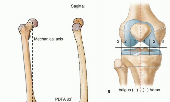 Optimizing Growth to Correct Pediatric Limb Deformities