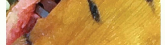 Illustration 40 for Achieve Lasting Pain Relief with Cemented Total Knee Arthroplasty