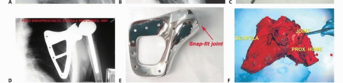 وصف طبي دقيق للمريض