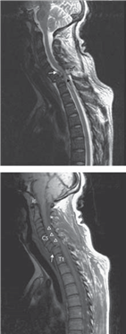Illustration 20 for Ace FRCS Orthopaedics: Oxford University Press Adult Pathology Viva