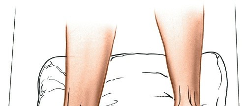 Essential Anterior & Posterior Approaches to the Medial Malleolus