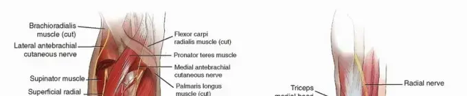 صورة توضيحية لـ دليل المريض الشامل لكسور الساعد: التشخيص، العلاج، والتعافي مع الأستاذ الدكتور محمد هطيف