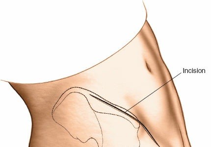 Illustration of sacroiliac joint anterior - Dr. Mohammed Hutaif