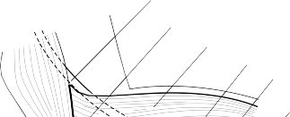 Illustration 31 for Radial Head Replacement: Solutions for Complex Elbow Injuries