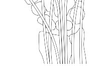 Illustration 18 for Mastering Wrist Surgery: Actions That Must Be Taken for Success