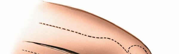 Accessing the Knee: Supporting Structures Lateral Approach