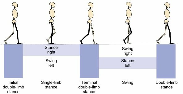 Illustration of peripheral vascular disease - Dr. Mohammed Hutaif
