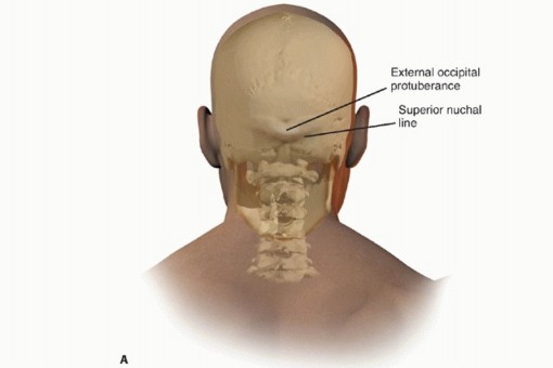 End Your Neck Pain: Posterior Cervical Laminoforaminotomy Explained