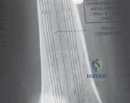Clinical Image