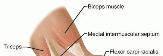 صورة توضيحية لـ وداعاً للألم والتنميل: دليلك الشامل لمتلازمة النفق المرفقي والعلاج على يد الدكتور محمد هطيف