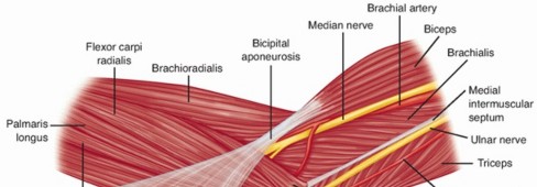 Stop Ulnar Nerve Symptoms: Medial Elbow Contracture Release