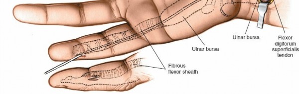 Illustration 245 for Essential Surgical Approaches: Uncover Every Aspect of the Wrist