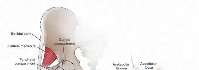 صورة توضيحية لـ مشاكل الغشاء الزليلي في الورك: الدليل الشامل للمرضى مع الأستاذ الدكتور محمد هطيف