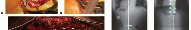 Management of Upper Extremity Electrical Burns: A Comprehensive Surgical Guide