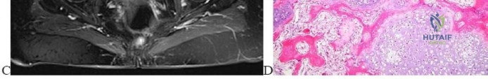 Epiphyseal Skeletal Dysplasias MCQs | Ortho Board Review