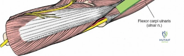 Illustration of shaft of the ulna - Dr. Mohammed Hutaif