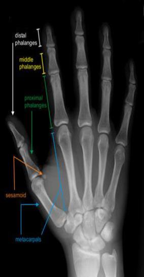 Carpalmetacarpal Joints: Understanding Injuries & Managing CMC Pain