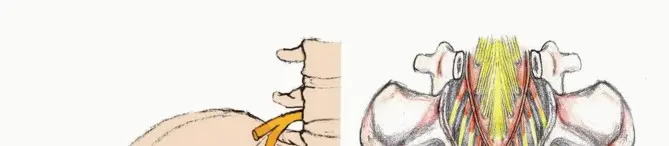 صورة توضيحية لـ جراحة أورام العجز: الحفاظ على وظائف الأمعاء والمثانة مع الأستاذ الدكتور محمد هطيف في صنعاء