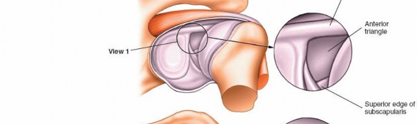 Illustration 228 for Essential Guide: Mastering Every Approach to the Shoulder