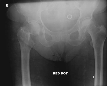 Illustration 5 for Ace Your FRCS: Key Questions in Trauma & Orthopaedics