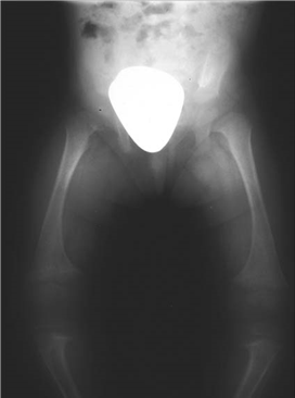 Illustration 14 for Pass Your Basic Sciences Viva: Key Anatomy & Pathology