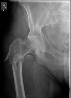Lower Limb Trauma: Decipher Anteroposterior (AP) Figure for Exams