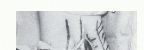 A Comprehensive Guide to Repair of Dislocating Peroneal Tendons