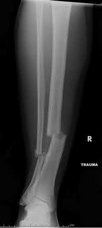 Illustration of orthocash a yearold woman - Dr. Mohammed Hutaif