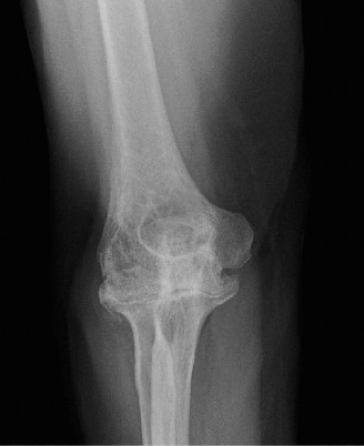 Illustration 110 for Acad Orthop Surg Challenge: Diagnose Shoulder Pain Case 1