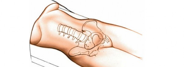 Expert Guide: Transperitoneal and Retroperitoneal Lumbar Access