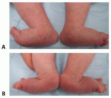 Illustration of treatment of vertical - Dr. Mohammed Hutaif