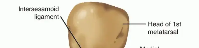 صورة توضيحية لـ وداعاً لآلام إبهام القدم المتيبس: دليل شامل لخشونة مفصل إصبع القدم الكبير وخيارات العلاج المتقدمة