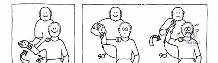 Illustration of glenohumeral dislocation glenohumeral - Dr. Mohammed Hutaif