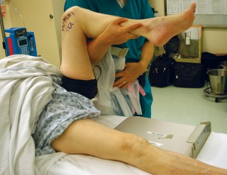 Illustration 10 for Optimize Tibial Component Alignment: Techniques for TKA Success