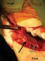 Orthopedic Surgery Board Review MCQs: AAOS Master Bank Part 37