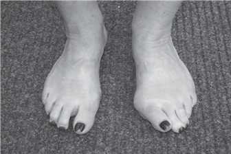 Illustration 3 for Ace FRCS Orthopaedics: Oxford University Press Adult Pathology Viva