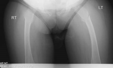 Illustration 18 for Master Hands and Paediatric Orthopaedics: Diagnose & Treat